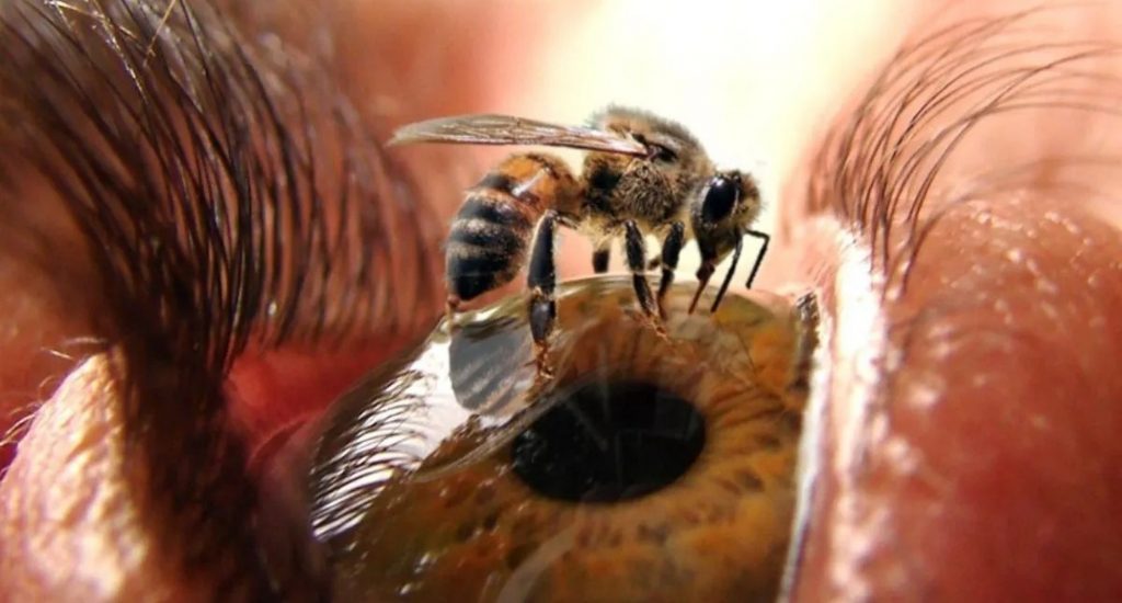 Encuentran cuatro abejas vivas en ojo de una mujer