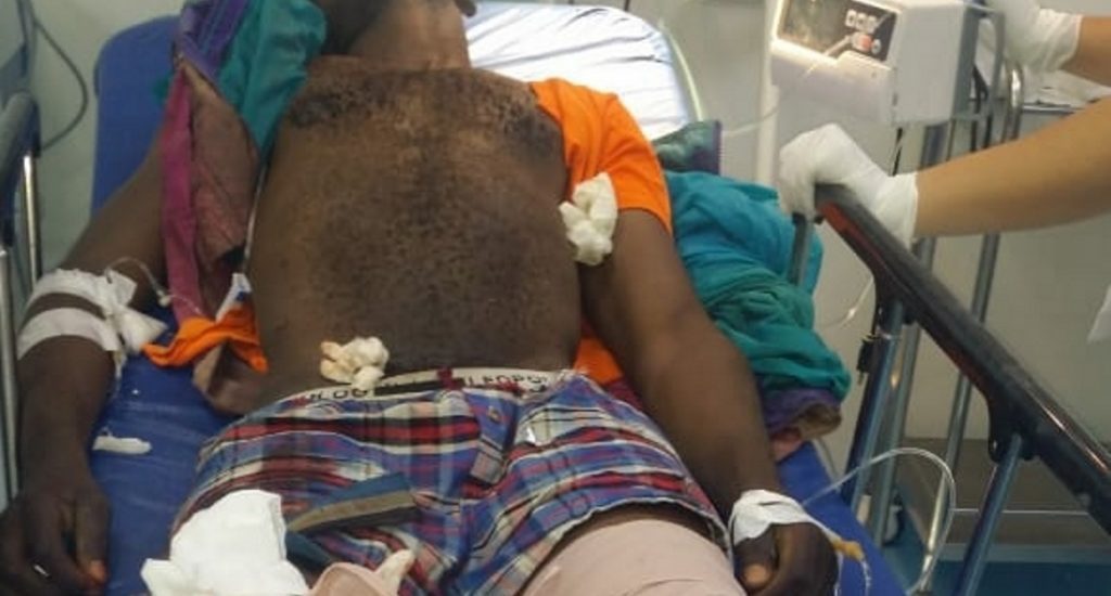 Haitiano pierde pierna izquierda al caer en cortadora de hierba en San Juan