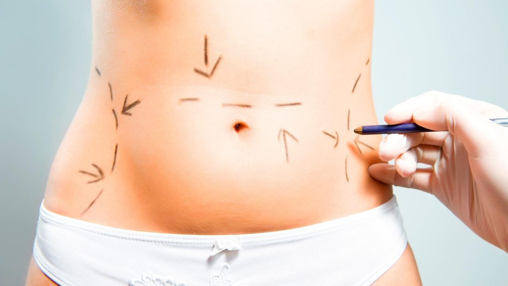 Cirugía de abdomen