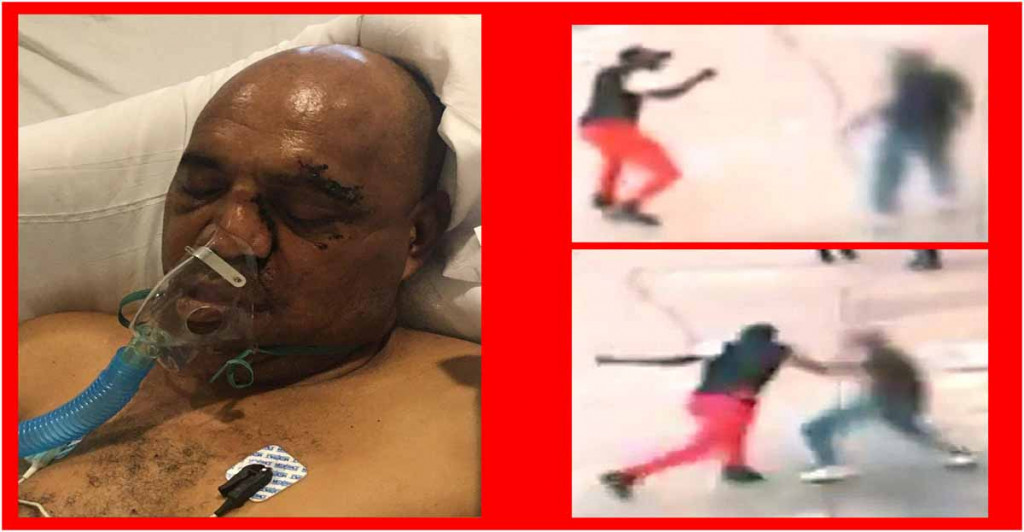 En coma desabollador dominicano golpeado brutalmente cuando se dirigía a iglesia Juan Guzmán Gómez large