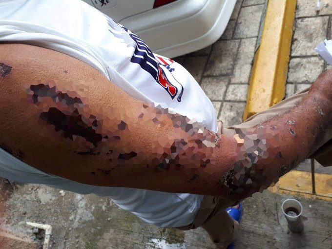 f91e7a61 f8ee 4b6b bbab b3bbfa1c1c73 large