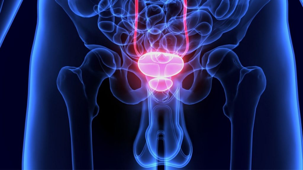 Cancer de prostata