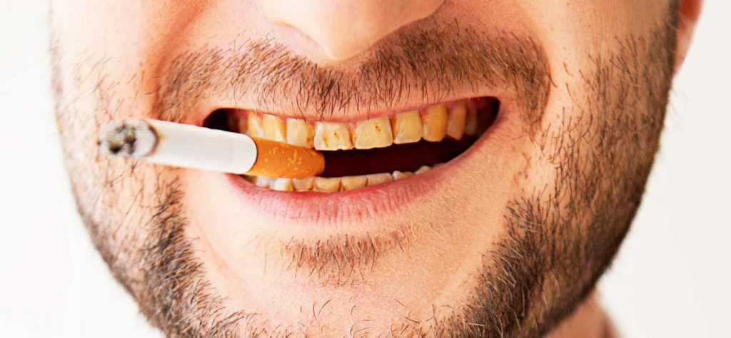 Dientes