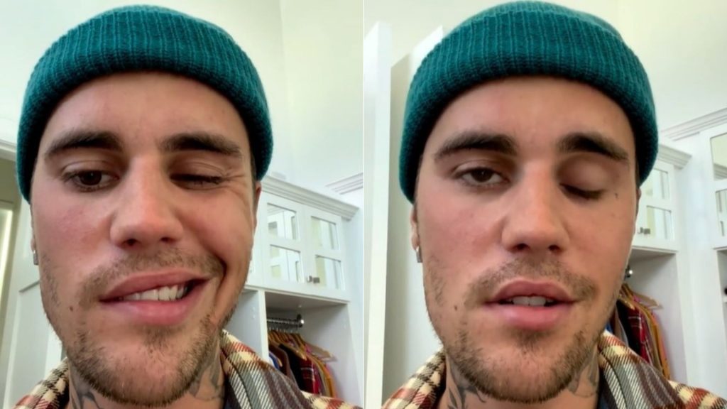 Justin Bieber confesó que sufre de parálisis en la mitad del rostro por un virus: “Es muy grave” Justin Bieber confeso que sufre de paralisis en la mitad del rostro por un virus Es muy grave