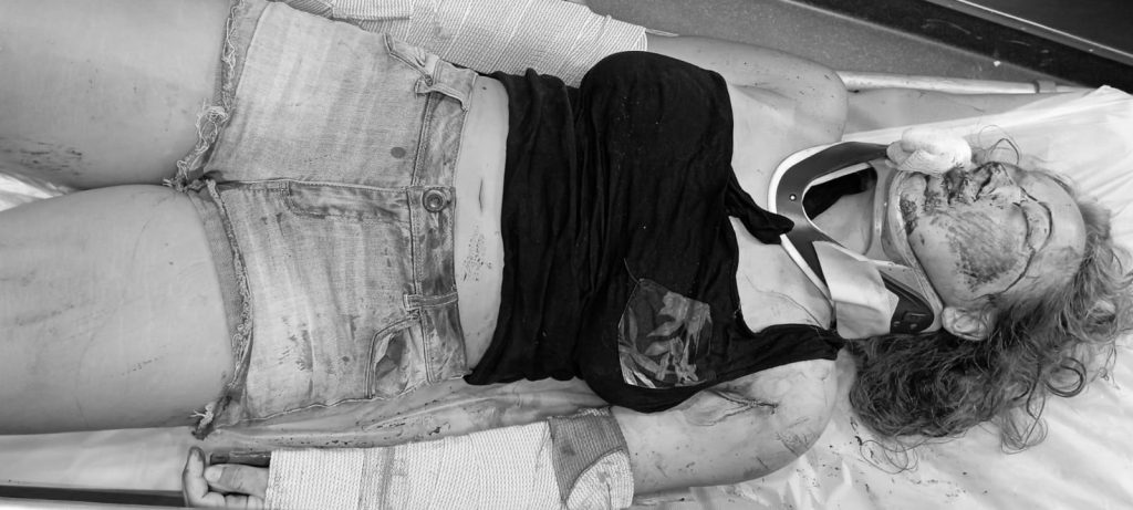 Norteamericana muere luego de caer de un segundo piso en Hotel Paraíso Caño Hondo en Sabana de la Mar Sara Caitlen Gobets