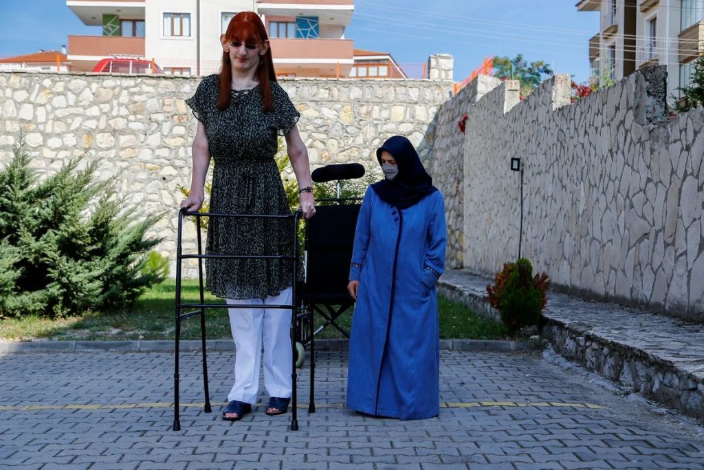 Rumeysa Gelgi la mujer mas alta del mundo