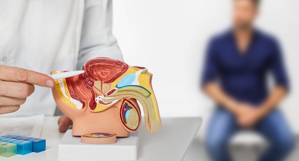 Esto es lo que tienes que comer para prevenir el cáncer de próstata Cancer de prostata