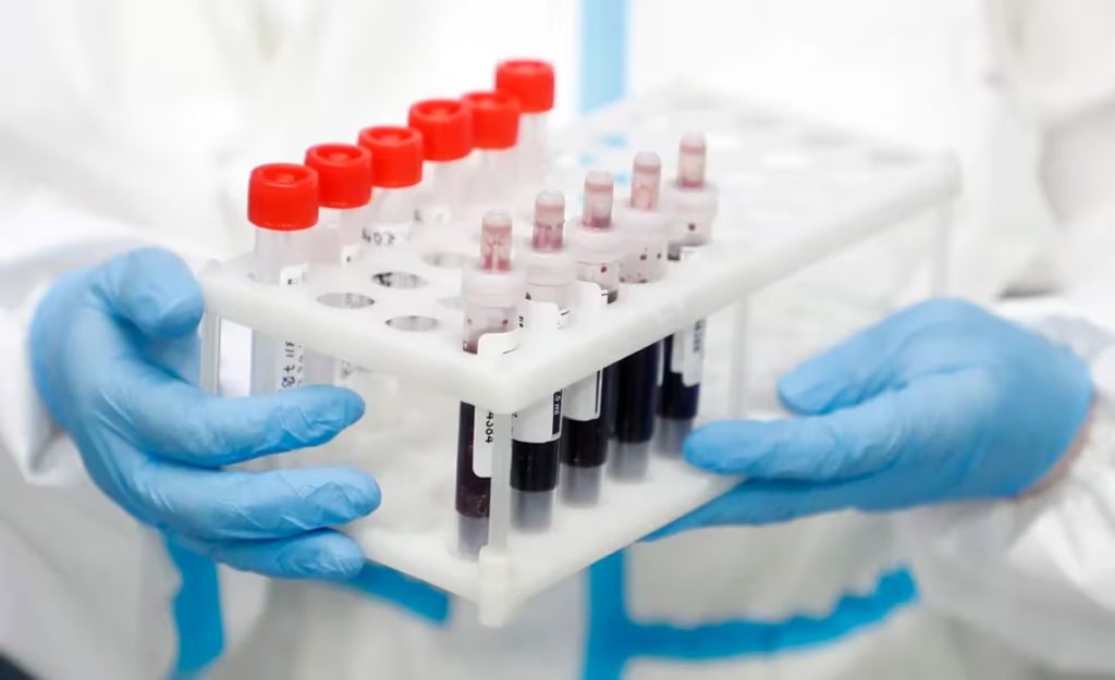sangre que detecta 18 tipos de cancer en etapas tempranas2