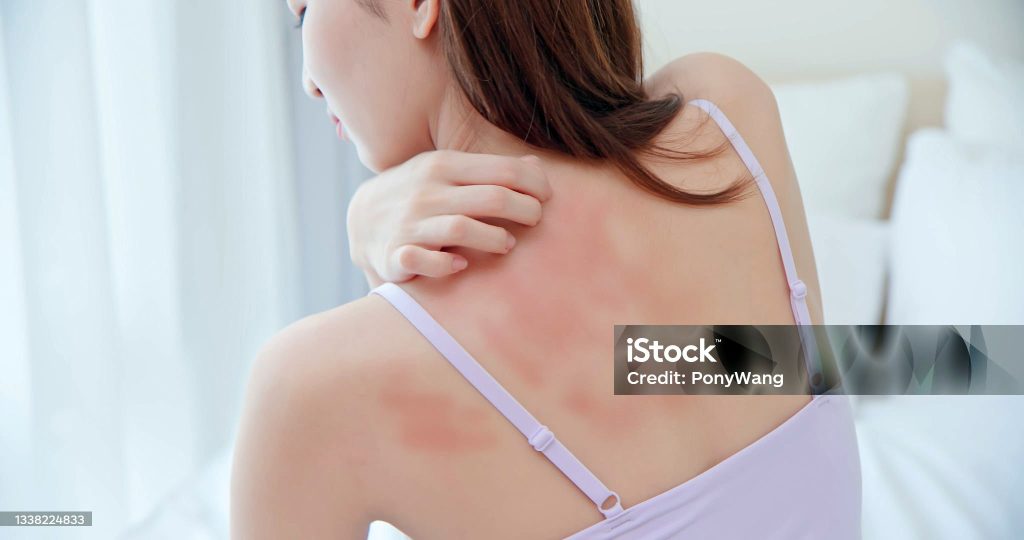 ¿Por qué se irrita la piel? (1 de 2) irritacion de tu piel eljacaguero