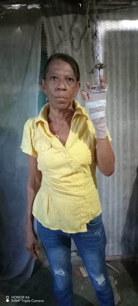 Dama herida en Villa Hermosa La Romana