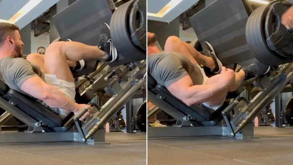 VIDEO: Fisicoculturista registra grave lesión al levantar 400 kilos en el gimnasio Lesion