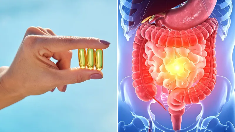 La vitamina D podría ayudar a regular la respuesta inmunitaria en personas con enfermedad inflamatoria intestinal image